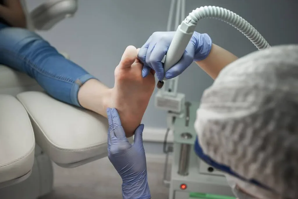 A medical podiatrist wearing purple protective gloves and a surgical cap uses a specialized micro-motor podiatry drill tool to treat the sole of a patient's foot.