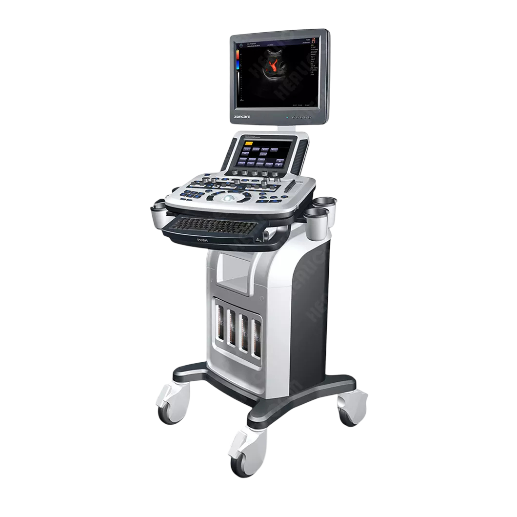 Colour Doppler ultrasound for varicose veins diagnosis Coimbatore