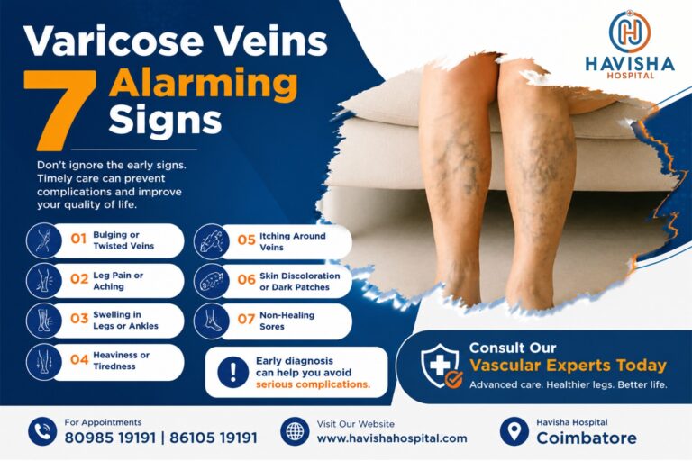 varicose veins in coimbatore