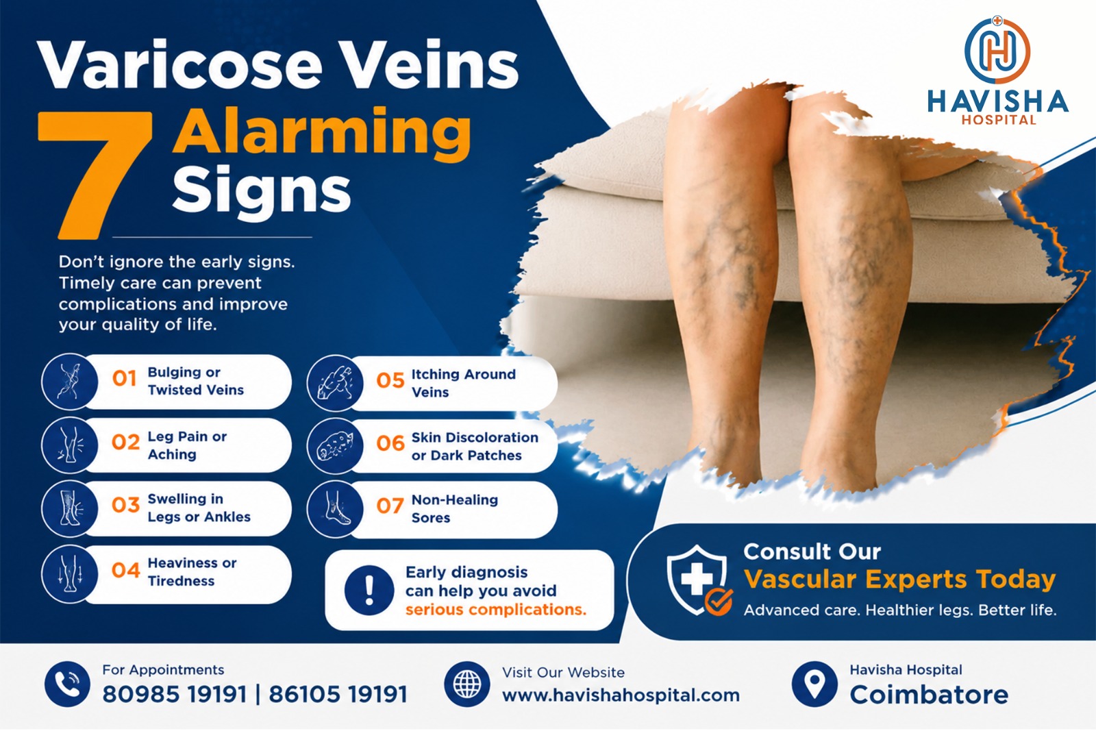 varicose veins in coimbatore