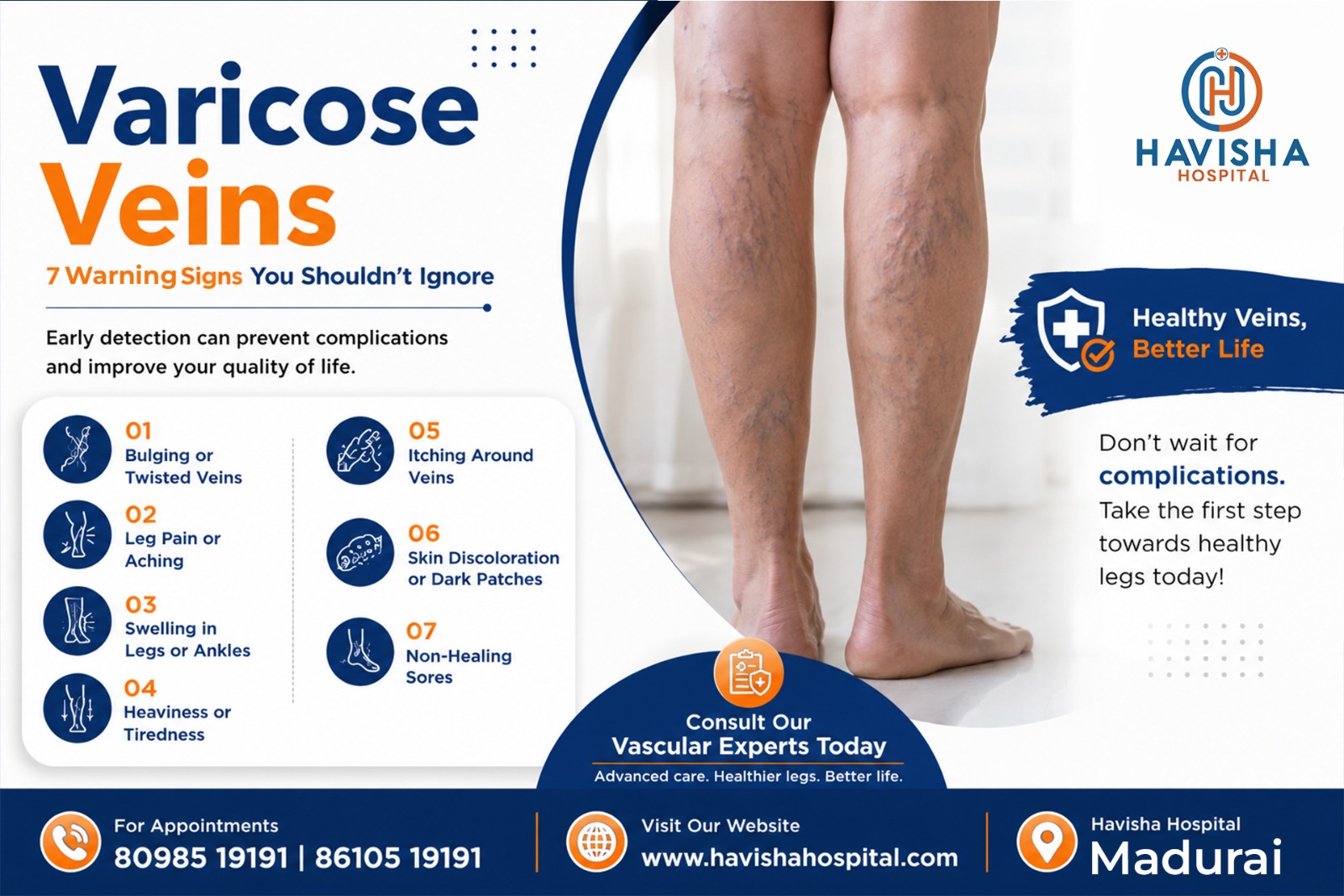 Warning signs of varicose veins in Madurai - Doppler ultrasound diagnosis