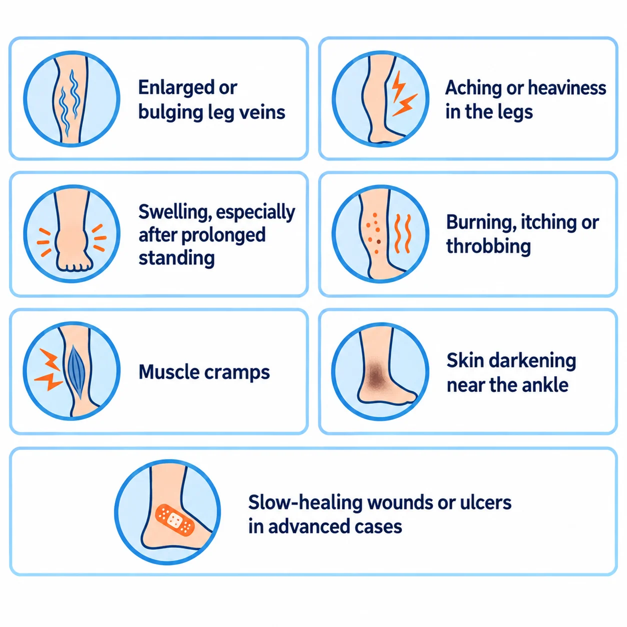 symptoms of varicose veins